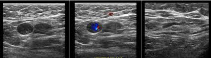 Header Image - COVID and Adenopathies.jpg
